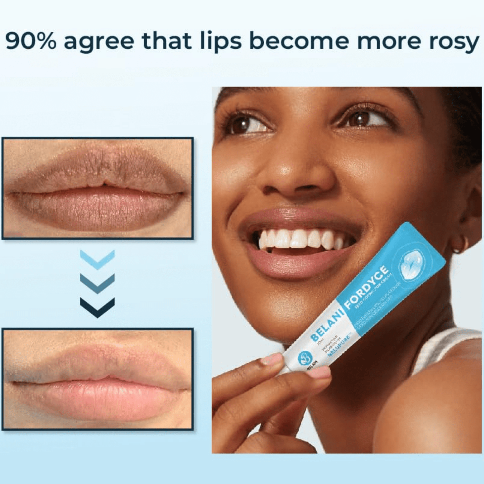 Belani Fordyce Spots Lip Cream, Hydrating Dark Lip Treatment, Fordyce Seeds 0.7 fl oz