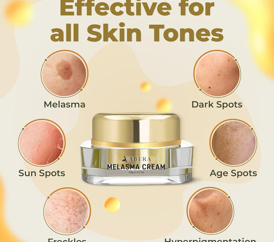 ABERA Melasma Cream