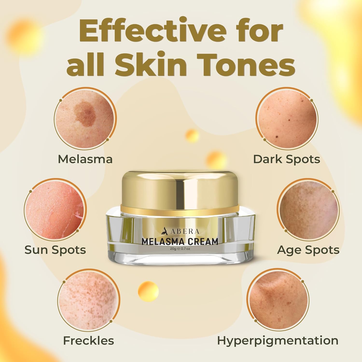 ABERA Melasma Cream