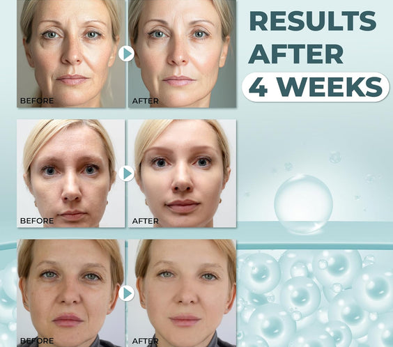 Abera Anti-Wrinkle Face Cream