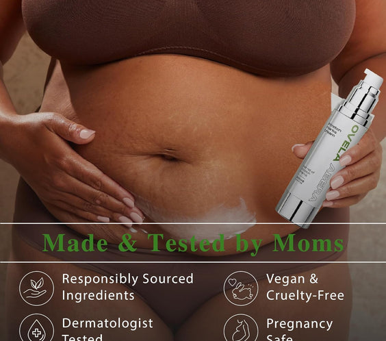 Abera Ovela Stretch Mark Cream