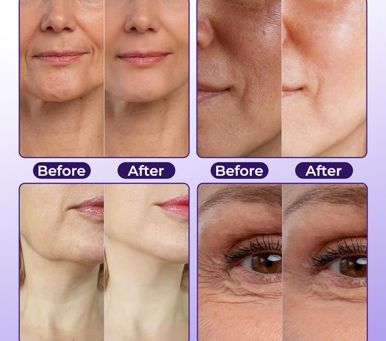 ABERA Belani Retinol Cream for Face