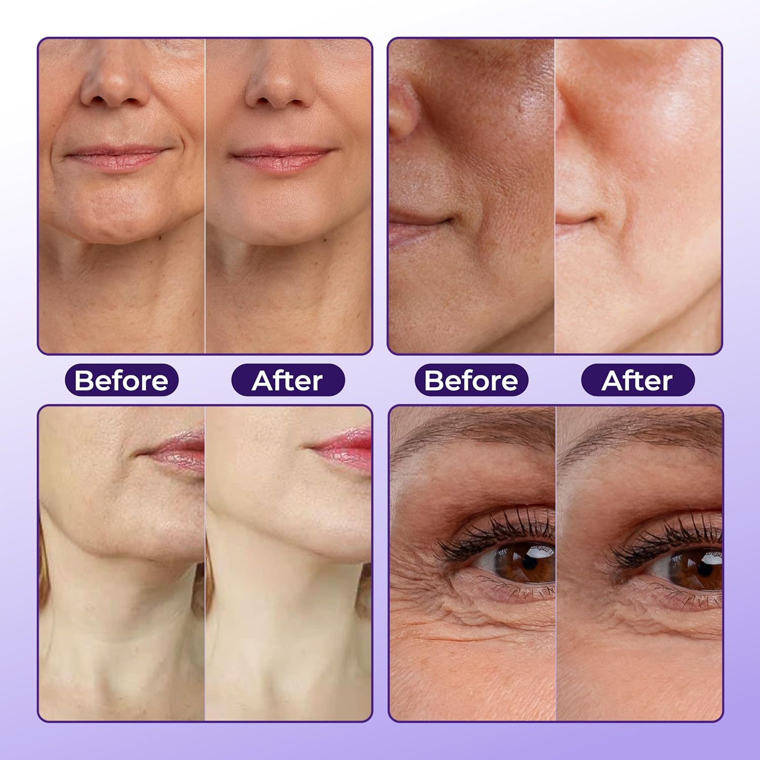 ABERA Belani Retinol Cream for Face