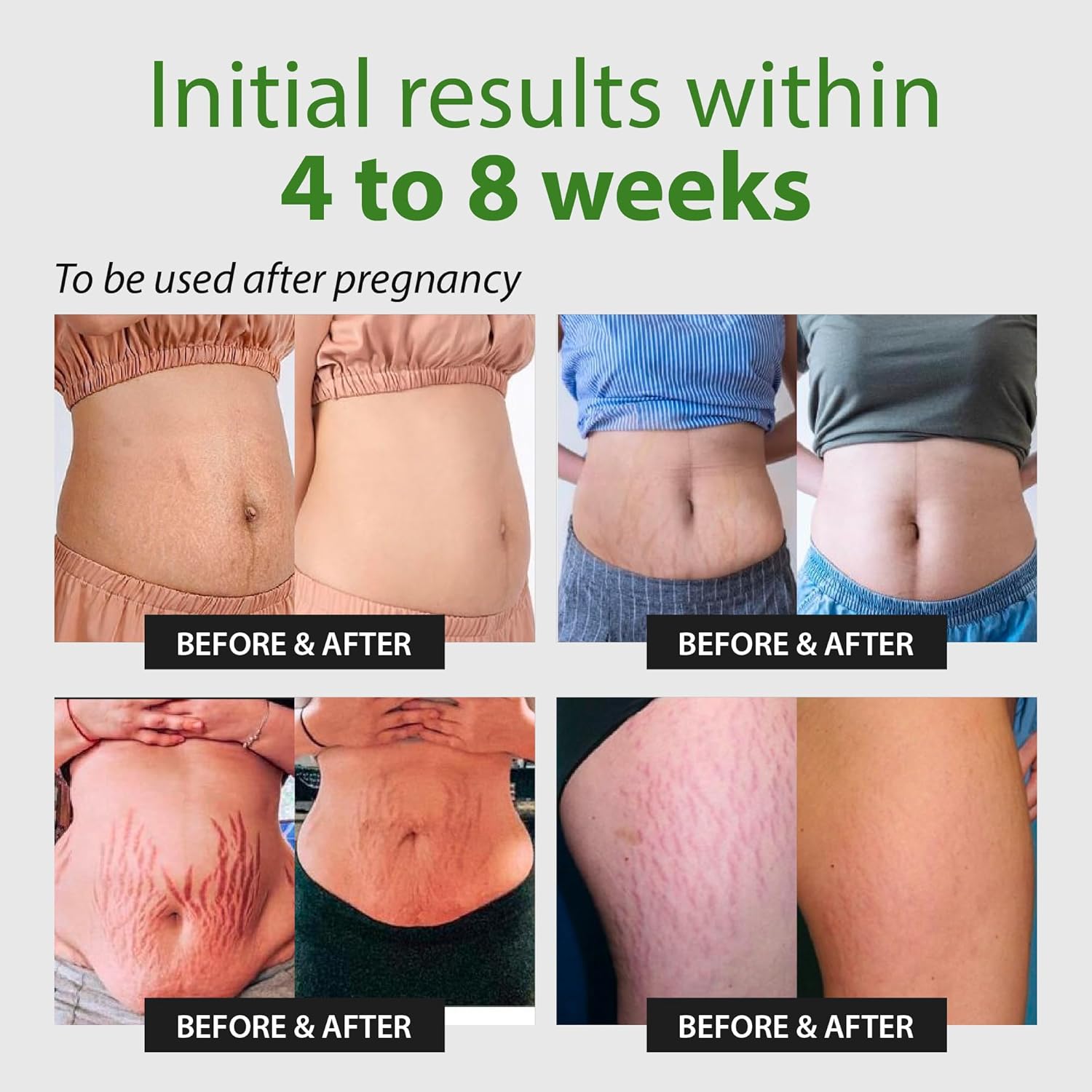 Abera Ovela Stretch Mark Cream