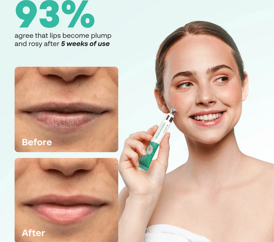 Abera Fordyce Cream – Advanced Formula with HPR (Next-Gen Retinoids), Fordyce Spot & Lip Acne Remover, All-day Moisturizing, Help Improve Dry, Chapped and Dark Lips, For Sensitive Lips (0.7 Oz)
