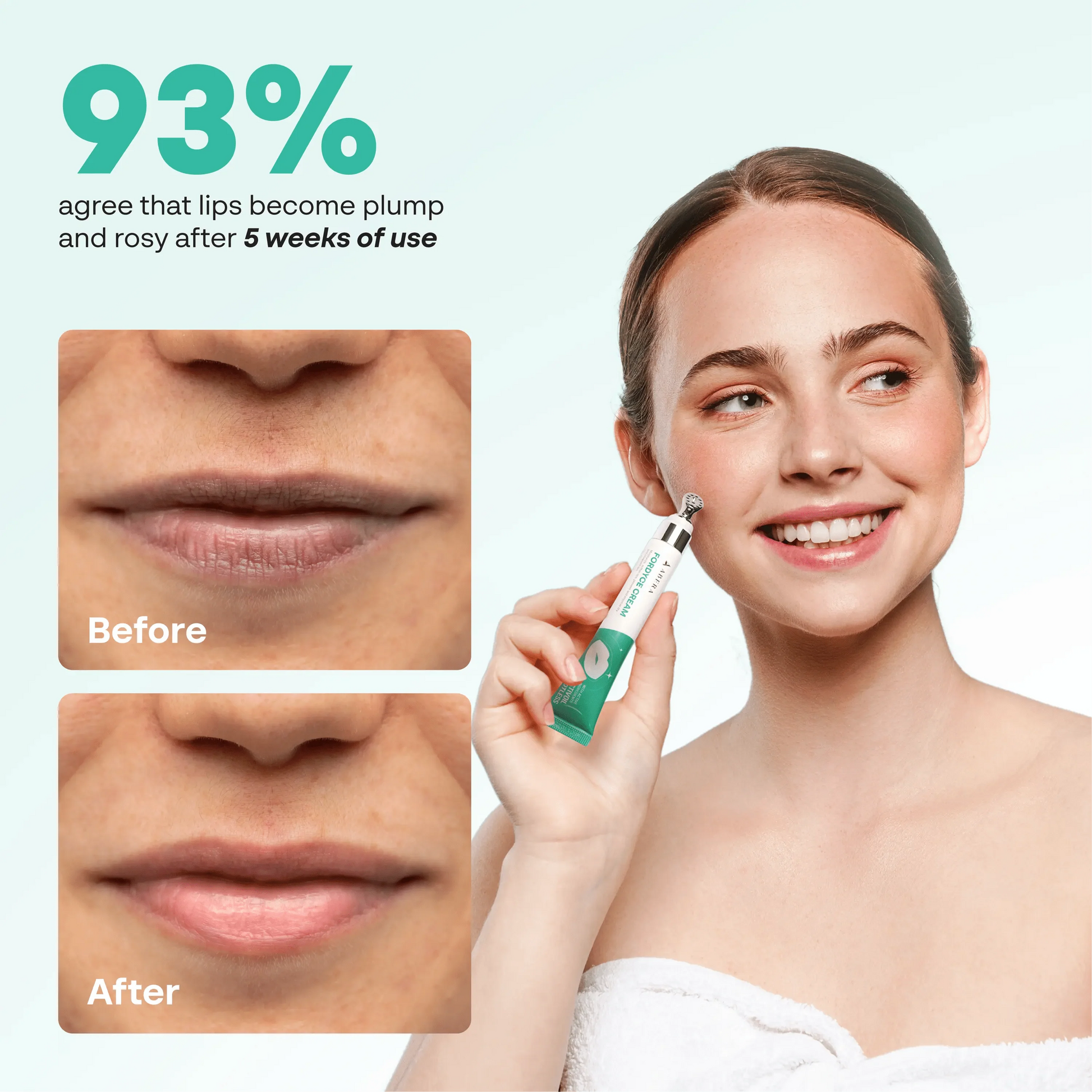 Abera Fordyce Cream – Advanced Formula with HPR (Next-Gen Retinoids), Fordyce Spot & Lip Acne Remover, All-day Moisturizing, Help Improve Dry, Chapped and Dark Lips, For Sensitive Lips (0.7 Oz)