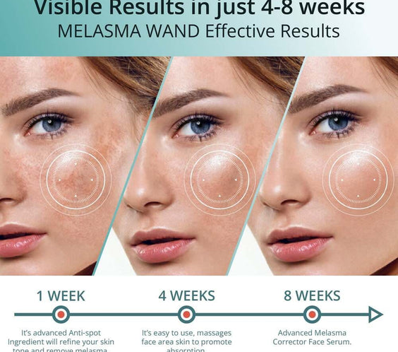 Abera Melasma Serum