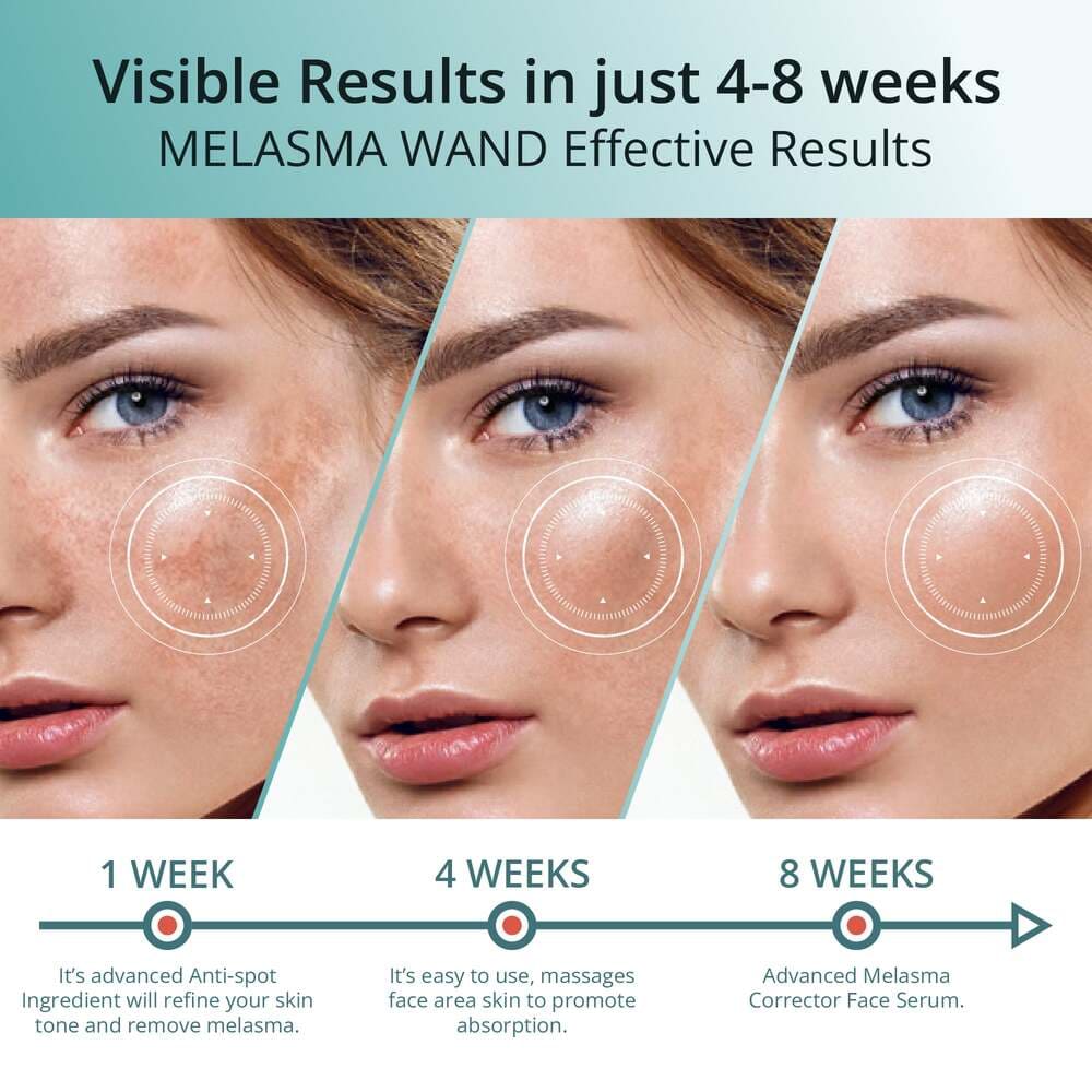 Abera Melasma Serum