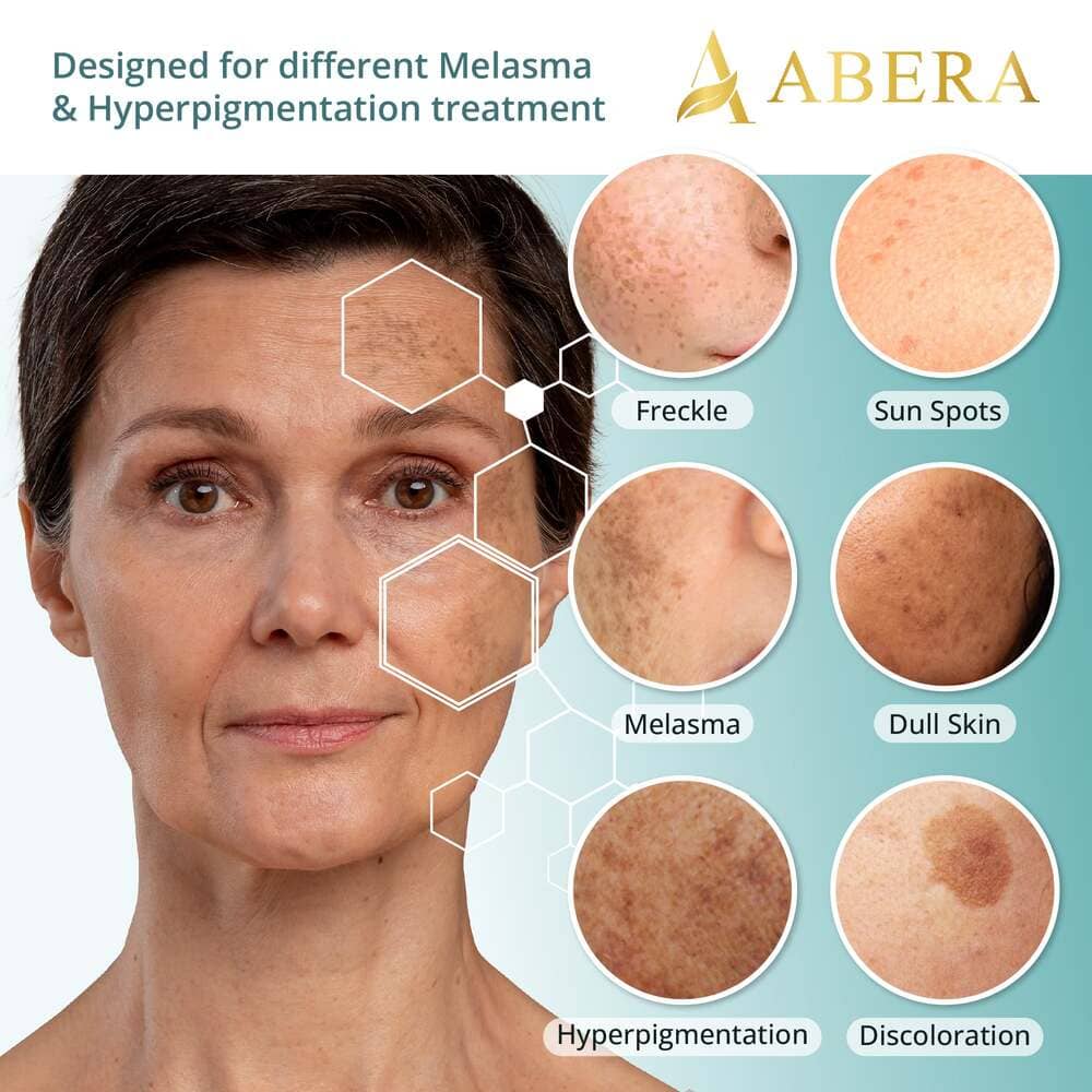 Abera Melasma Serum