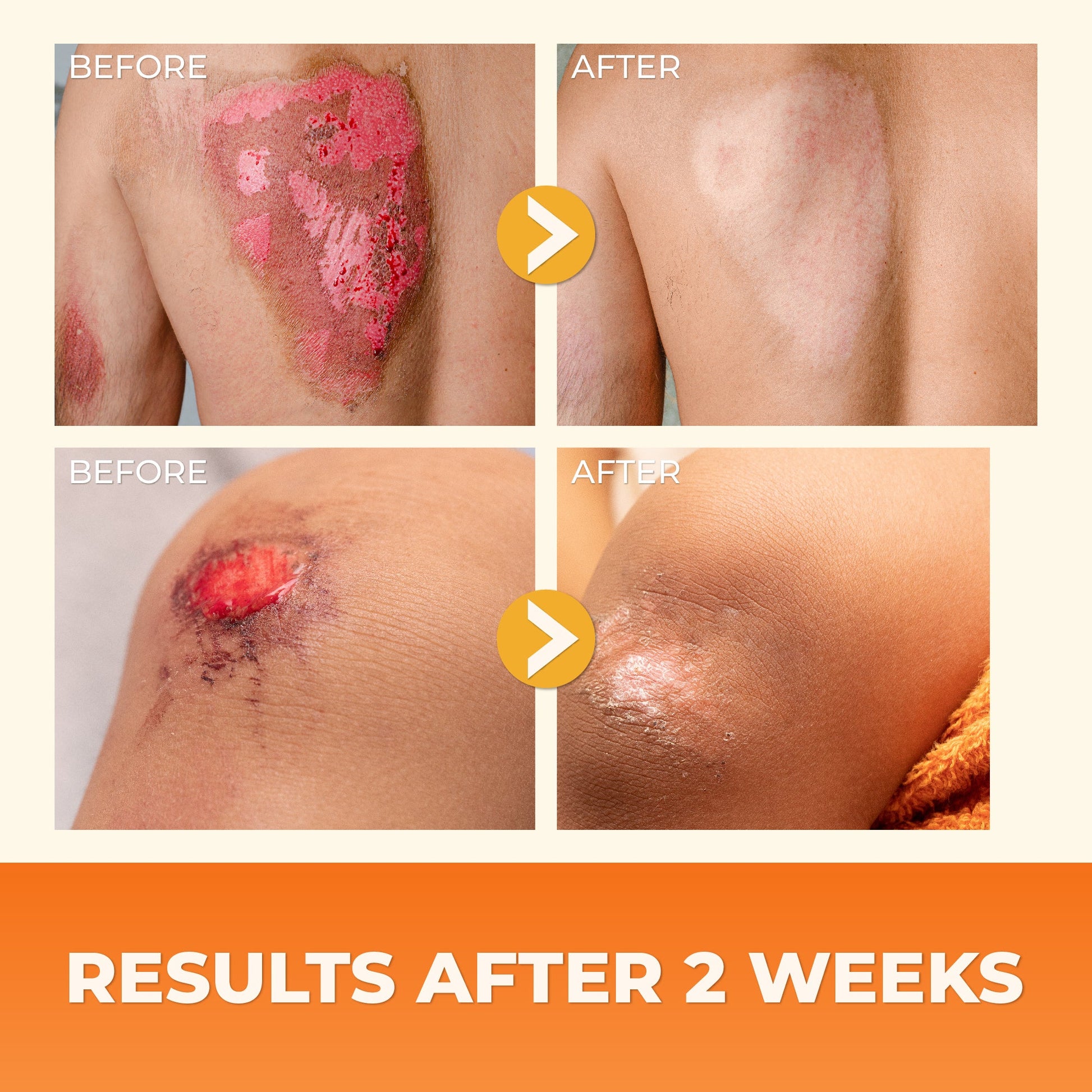 ABERA Red Turmeric Scar Removal Cream