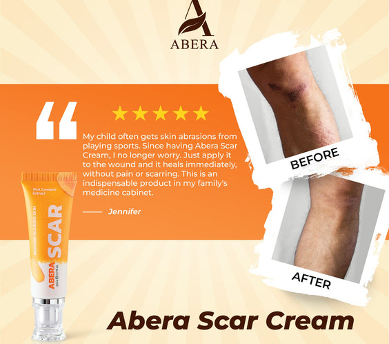 ABERA Red Turmeric Scar Removal Cream
