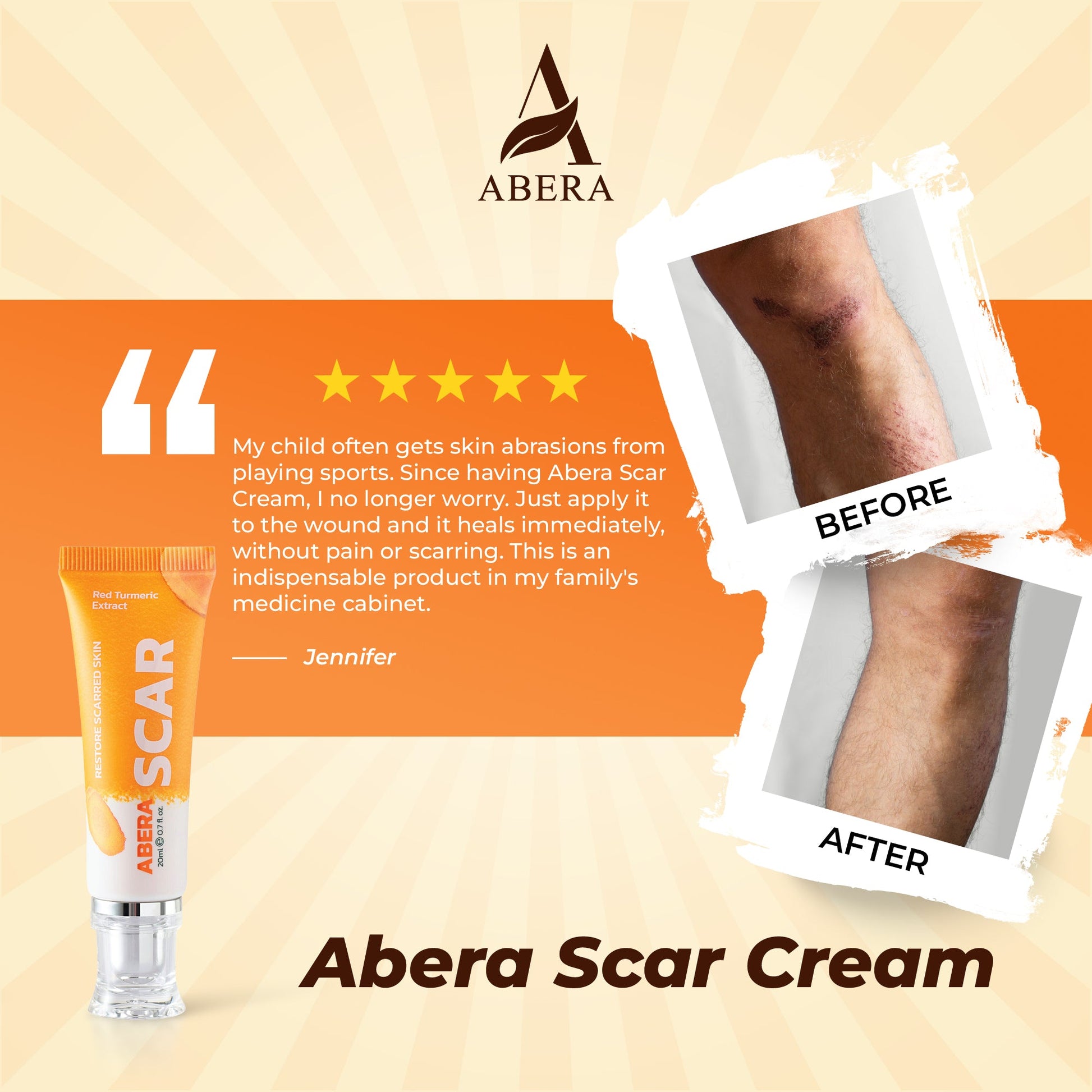 ABERA Red Turmeric Scar Removal Cream
