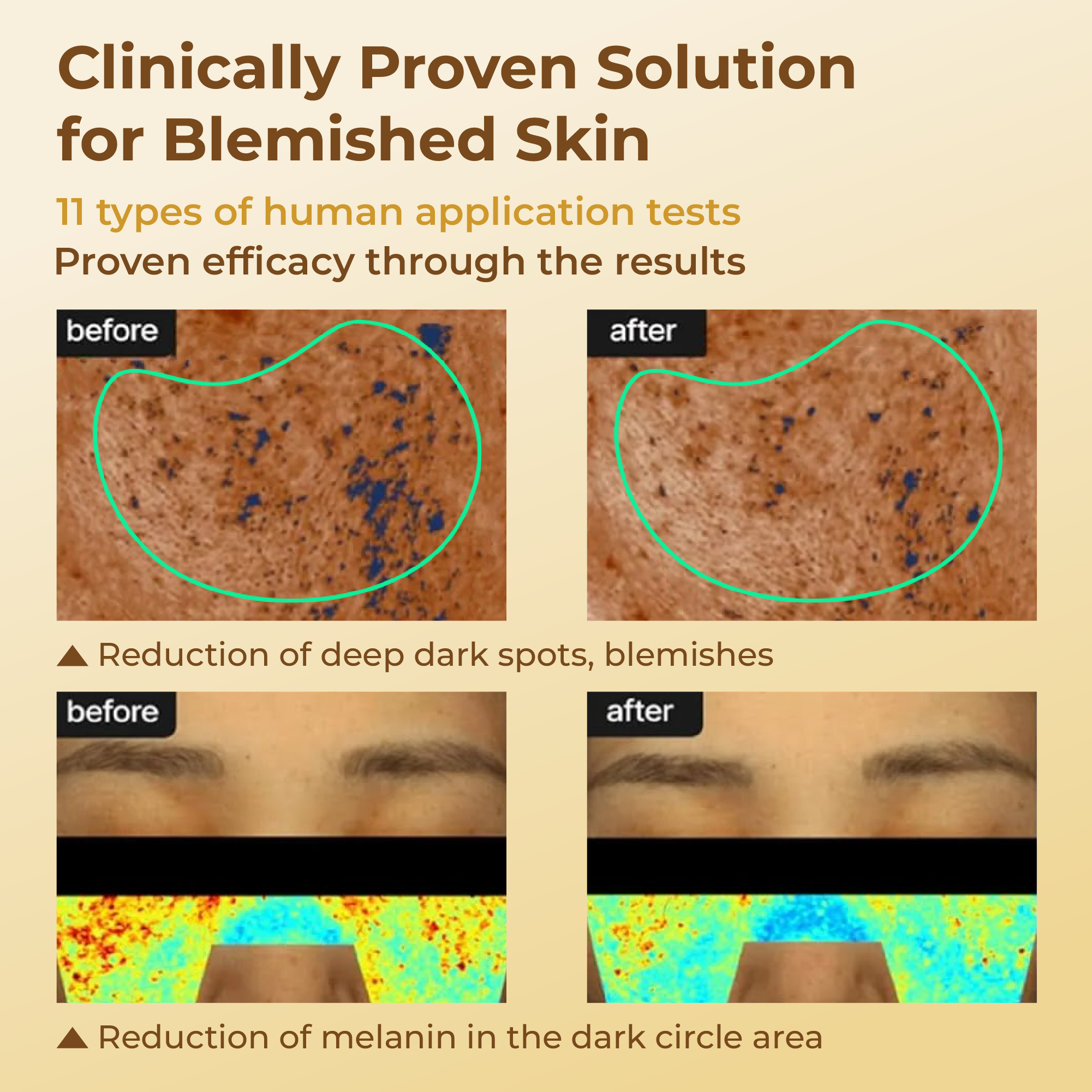 ABERA Kasumi Glowing Cream | Brightening Care for Uneven Skin - ABERA SHOP