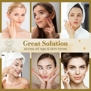 ABERA Melasma Cream - ABERA SHOP