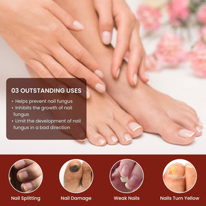 Abera Nail Fungus Serum - Hydrating & Conditioning Formula for Dry or Hardened Nails – Quick - Drying Daily Nail Support - ABERA SHOP