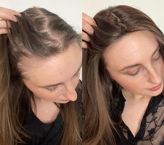 Abera Hair Growth Serum