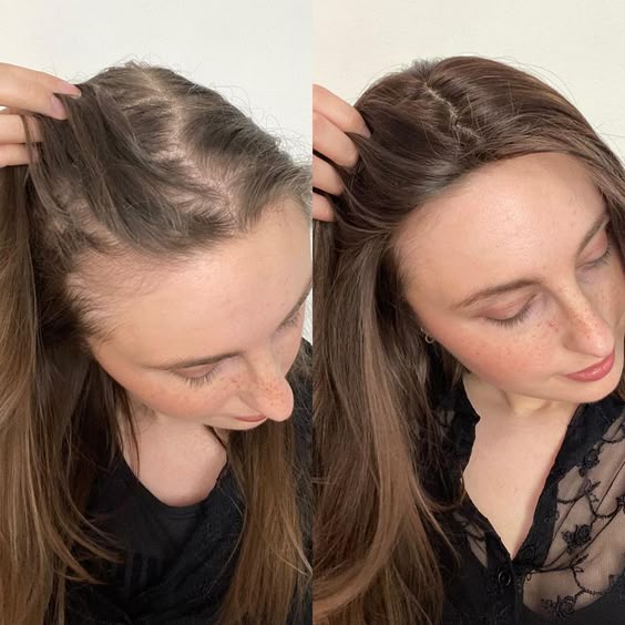 Abera Hair Growth Serum