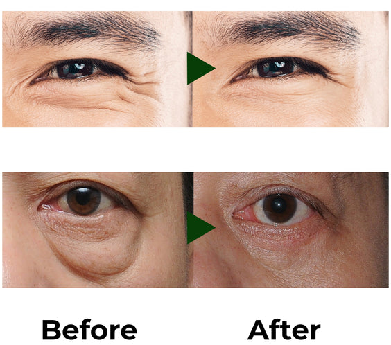 Abera Eye Roller Serum
