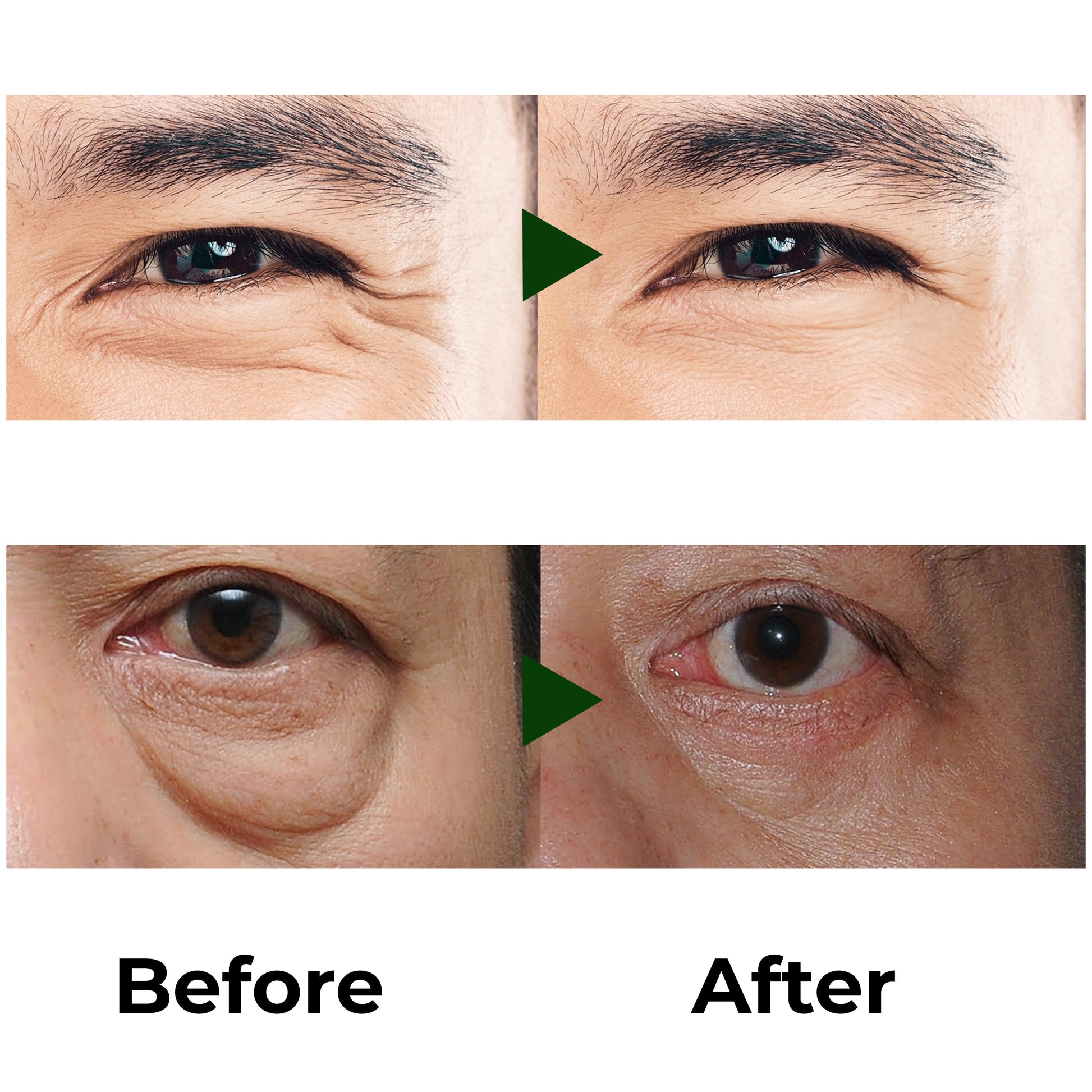 Abera Eye Roller Serum