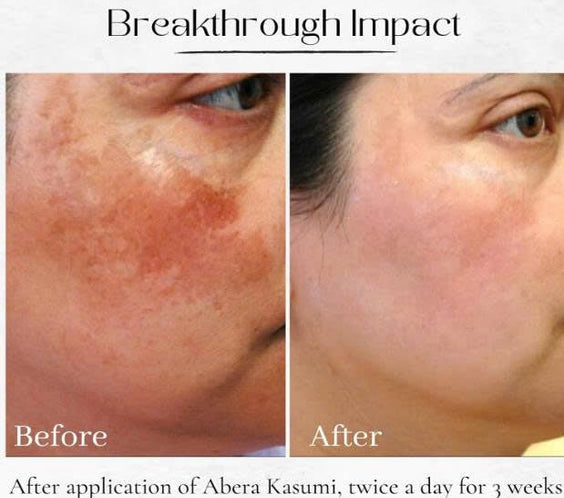 ABERA Kasumi Glowing Cream