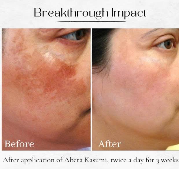 ABERA Kasumi Glowing Cream